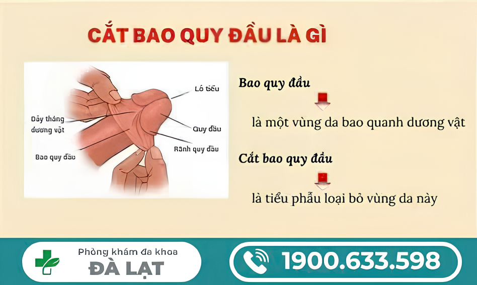 Hình ảnh minh họa